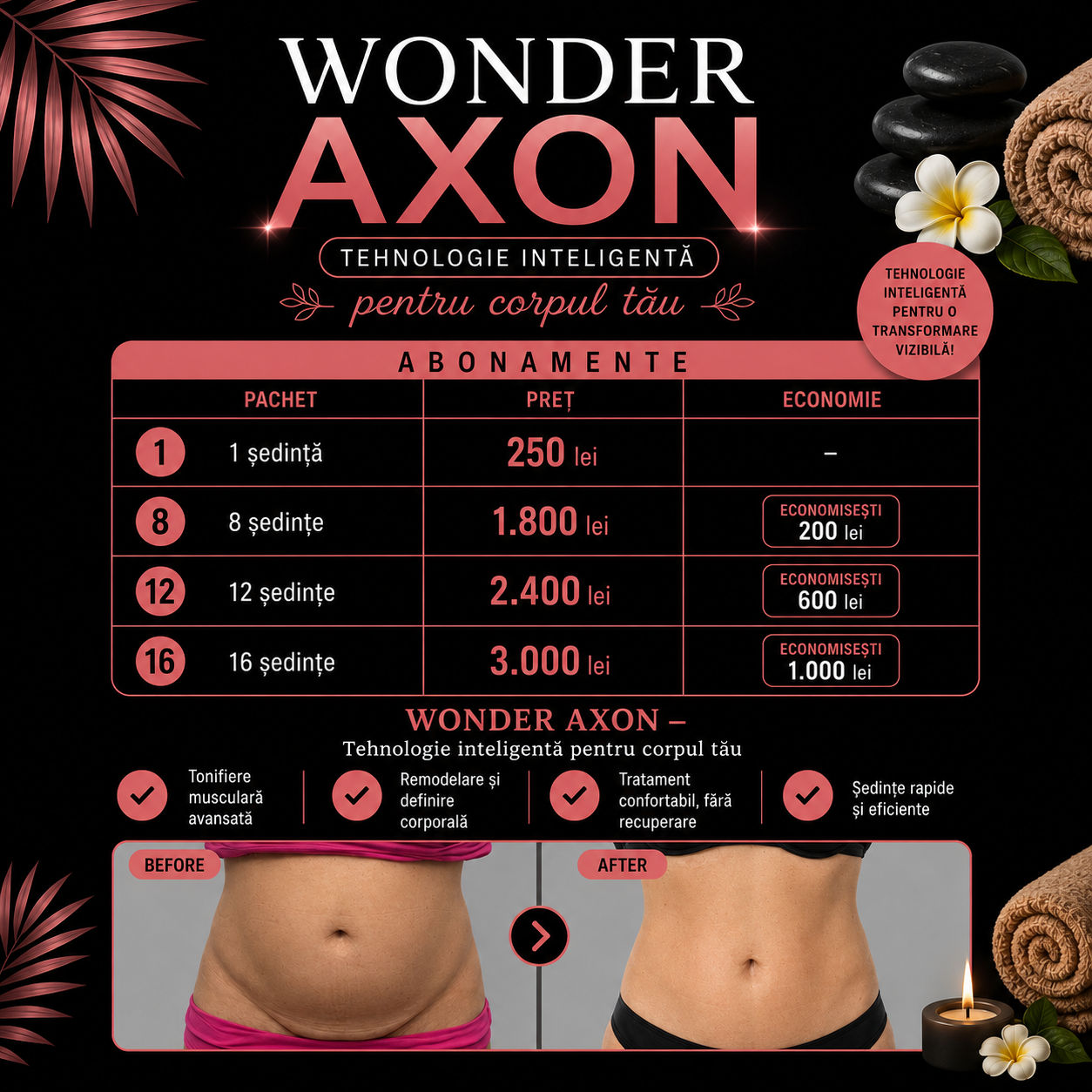 Wonder Axon